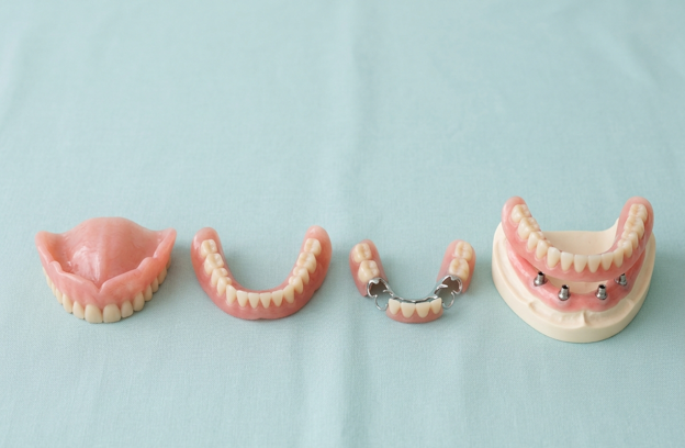 Row of dental prosthesis models on a blue background: lower denture, partial denture, implant bridge, and upper implant-supported denture.