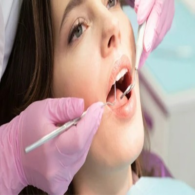Smile Designing 1 - The Smile Connect Close-up of a patient with mouth open in a dental exam, dentist wearing pink gloves using dental tools.