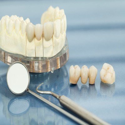 cosmetic crown 1 - The Smile Connect Dental model showing a row of teeth with a separate dental crown and a mirror on a blue surface.