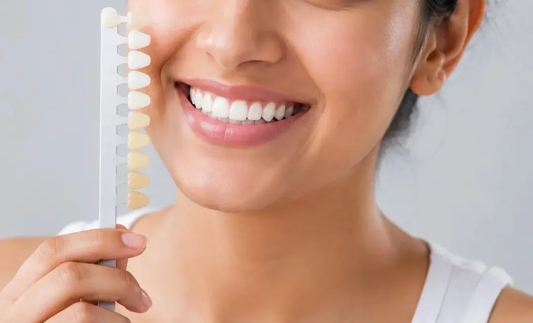 Is Teeth Whitening Safe, and How Long Do the Results Last?
