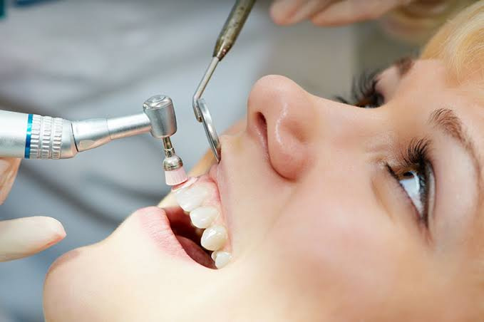 Woman lying back during a dental procedure; a dentist uses a drill and scaler near her teeth.