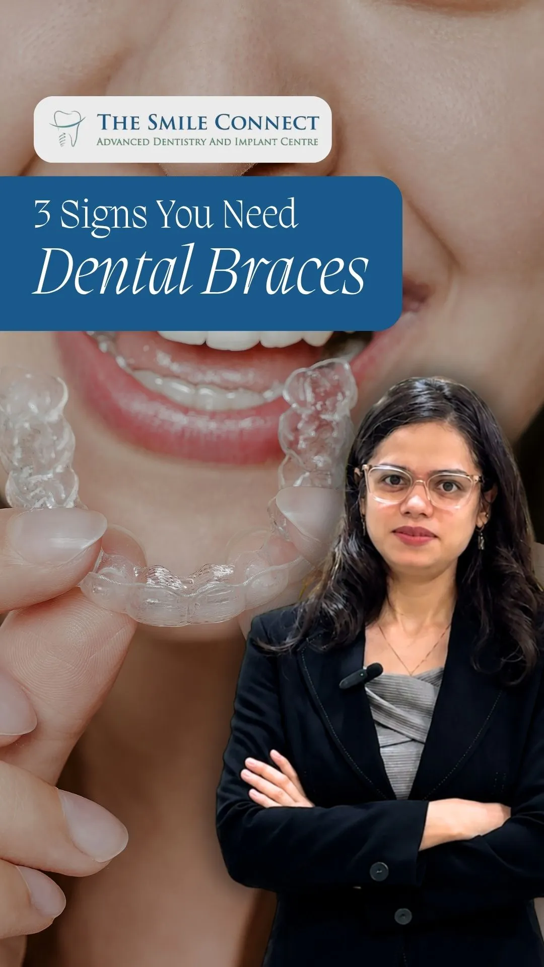The Smile Connect logo and the headline '3 Signs You Need Dental Braces' over a close-up of a smiling person holding clear dental aligners.