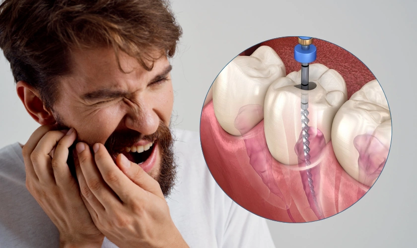 Dental Crown Pain After Root Canal: Causes, Symptoms & When to Seek Treatment