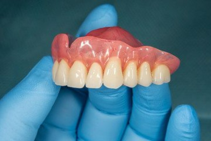 Immediate denture 1 - The Smile Connect Dentist in blue scrubs and gloves uses a dental drill on a patient with an open mouth.