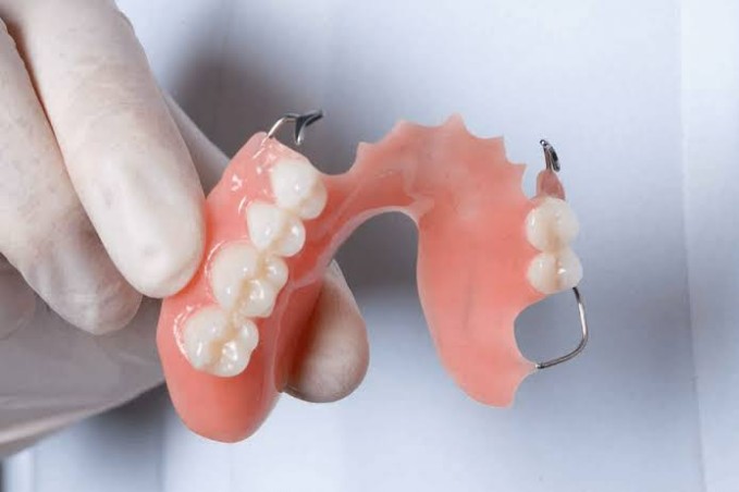 Partial Denture 1 - The Smile Connect Dental laser used on a front tooth during a dental procedure, with the tip emitting a small bright glow near the gumline.