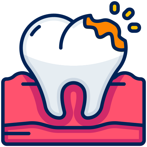 broken-teeth - The Smile Connect Cartoon tooth with a cavity at the crown and pink gums, illustrating tooth decay point-to-tooth decay