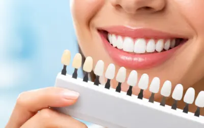 How Long Do Teeth Whitening Results Usually Last?