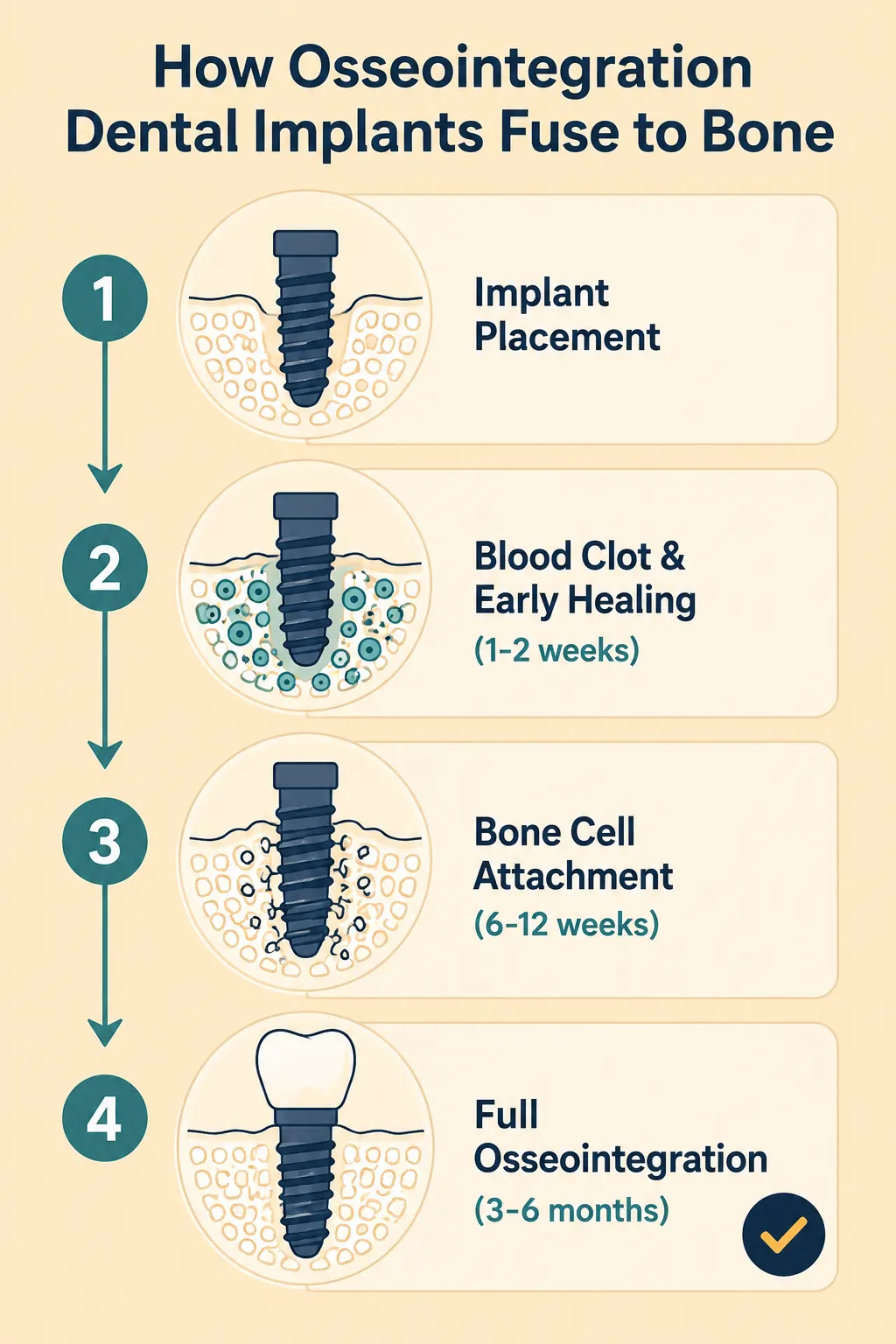 What Actually Happens During Osseointegration - The Smile Connect What Actually Happens During Osseointegration